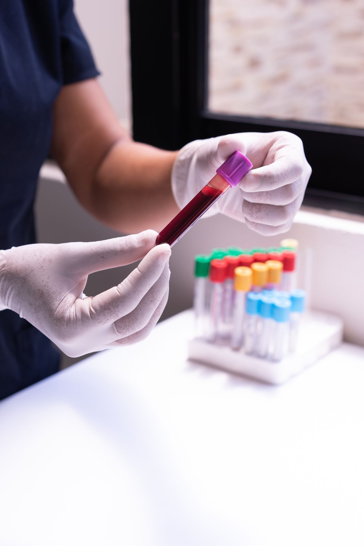 A healthcare worker checking a blood sample